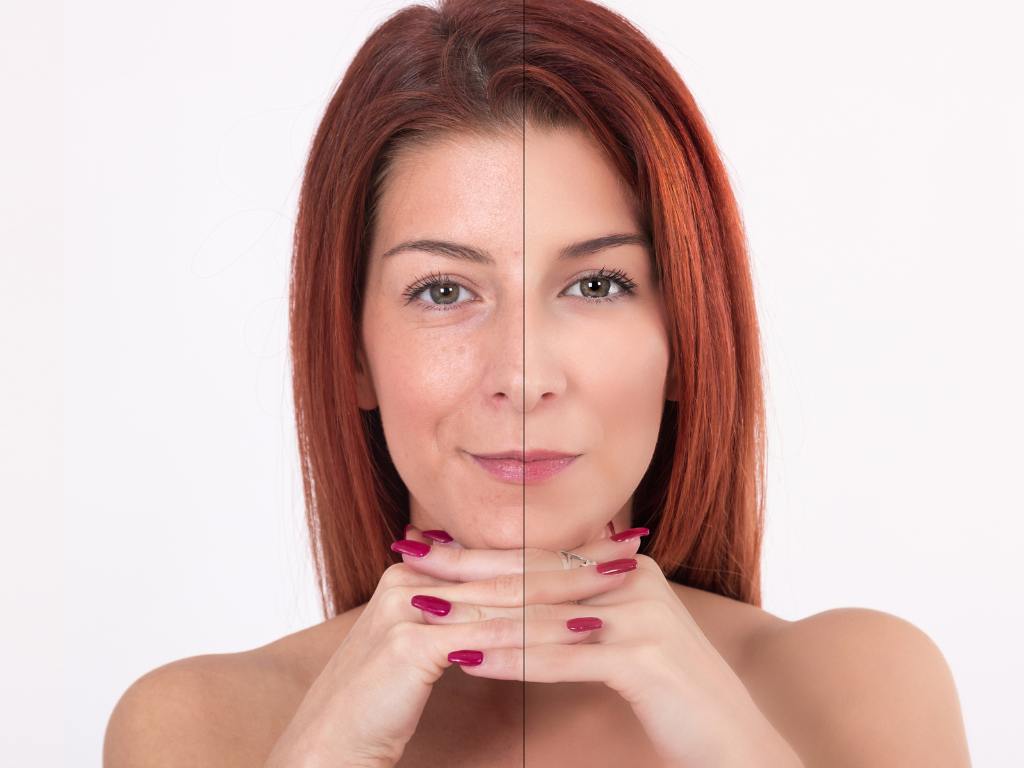 Diferenças entre peles