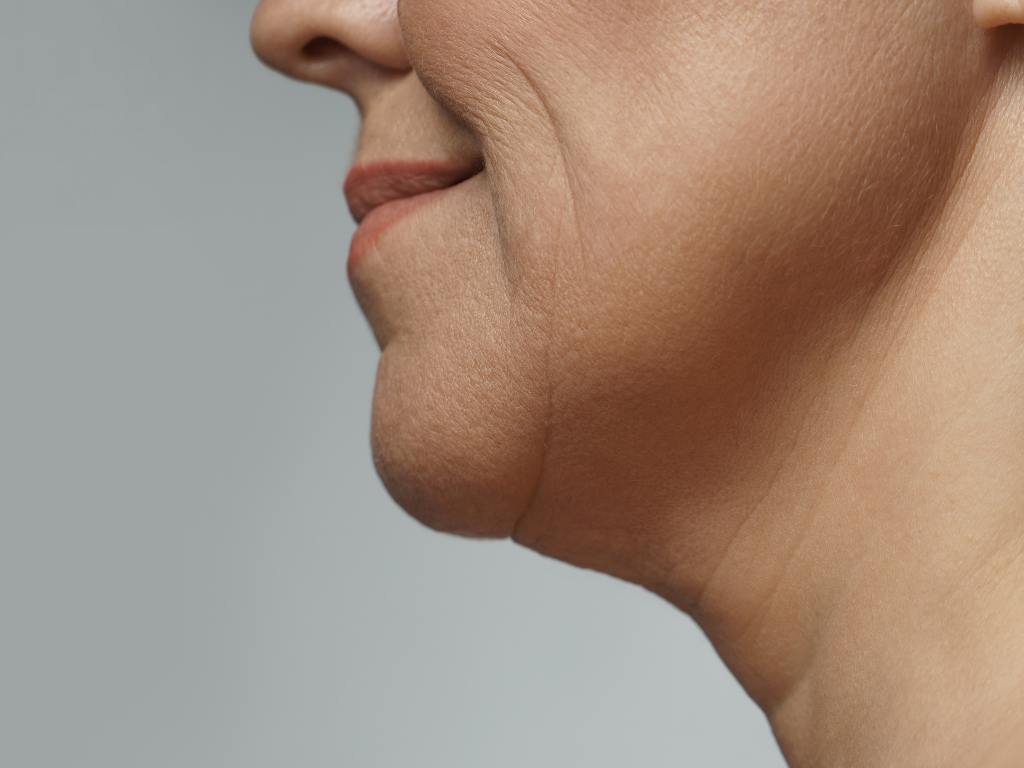 Perfil de uma mulher com linhas de expressão no rosto