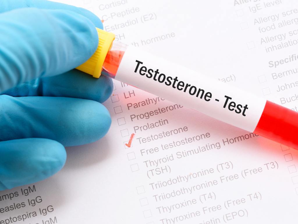 Teste de testosterona