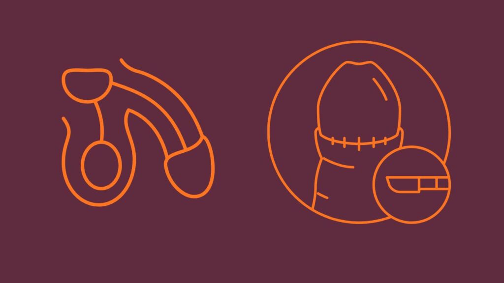 circuncisão antes e depois