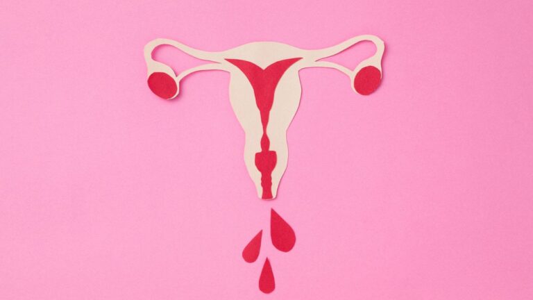 útero com menstruação desregulada