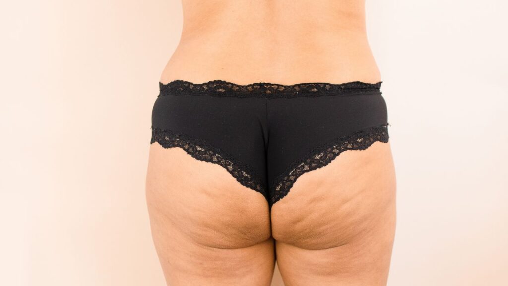 bumbum de mulher com calcinha preta e celulite