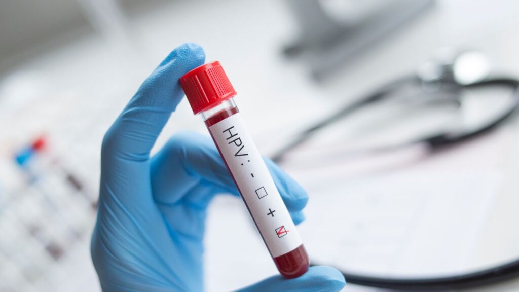 exame de hpv