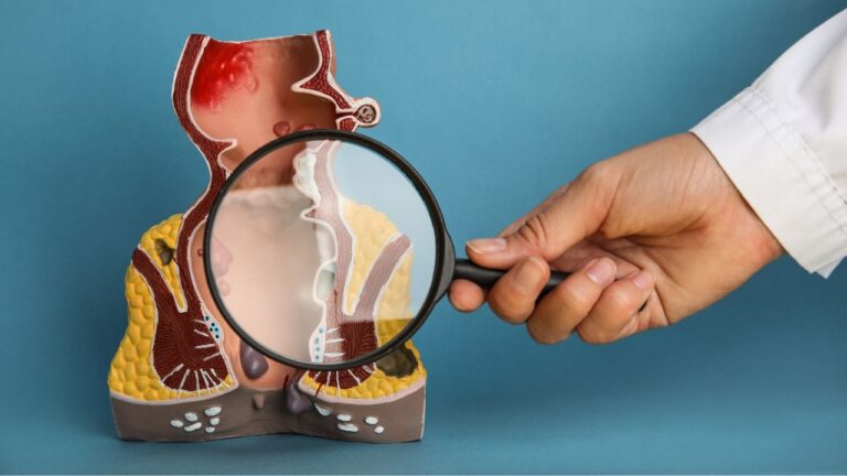 maquete de ânus com uma lupa para ilustrar exame de preventivo anal